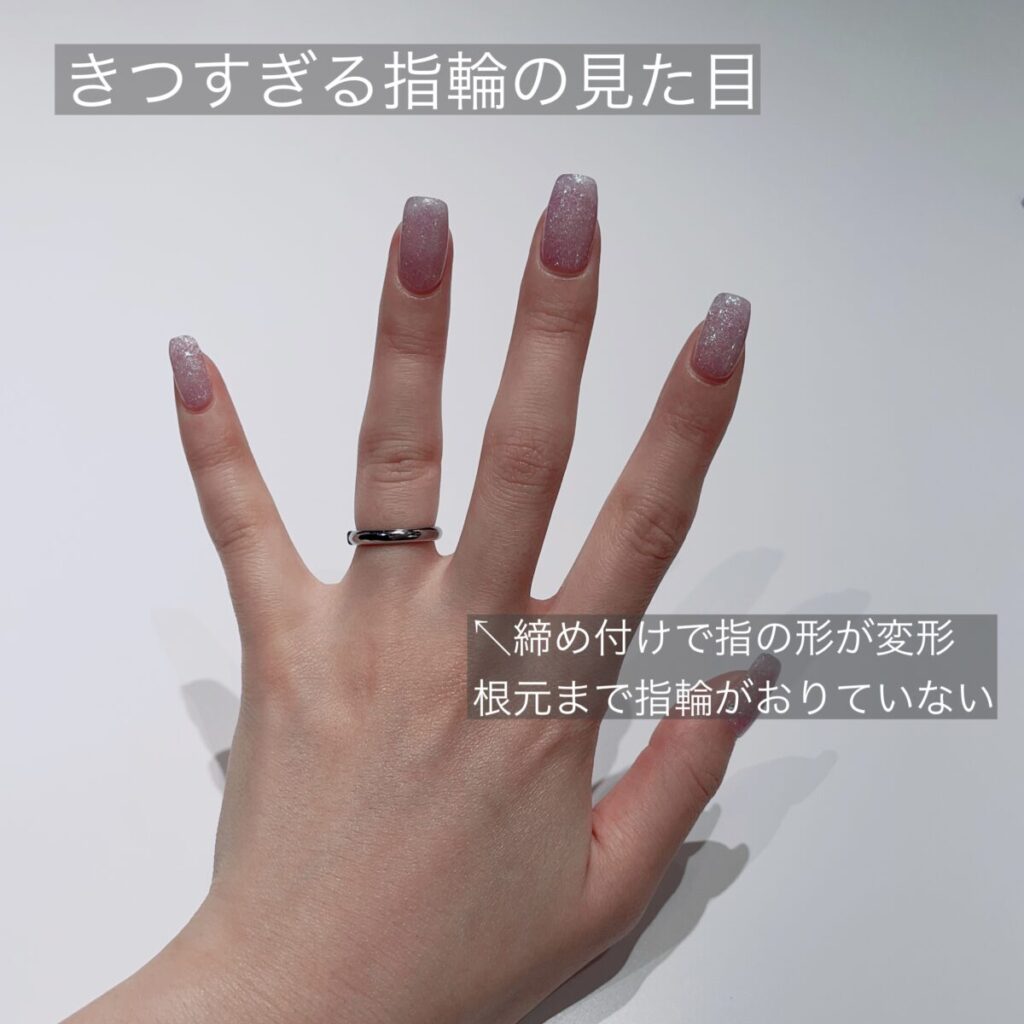 きつすぎる指輪をつけた手元。指輪の締め付けで指の形が変わり根元まで指輪がおりていない。